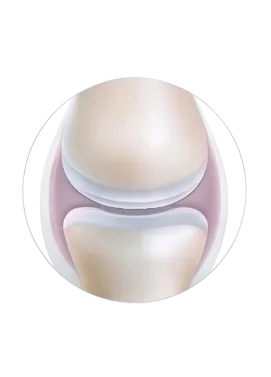 Collagen Type II
